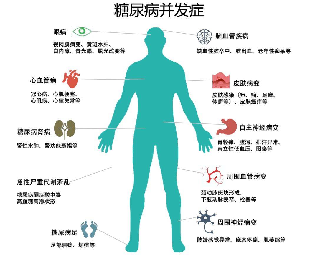 全球|吃糖吃多了会得糖尿病吗？