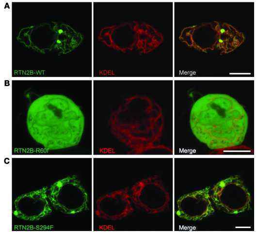 治疗|遗传性痉挛性截瘫护理方法