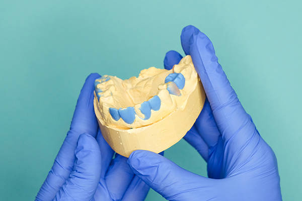 换牙齿多少钱合适 168309a1918c4765817babccc0573505.jpeg