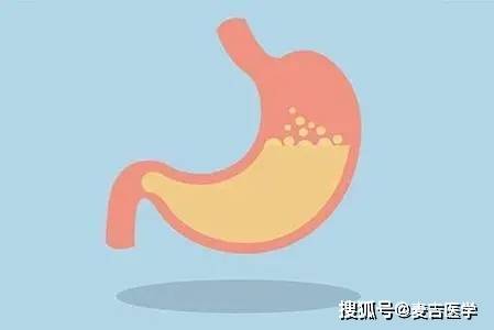 肠道|胃酸倒流是由什么原因引起的?听听医生怎么说？