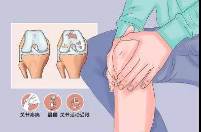 针灸|针灸何以治疗膝关节骨性关节炎？