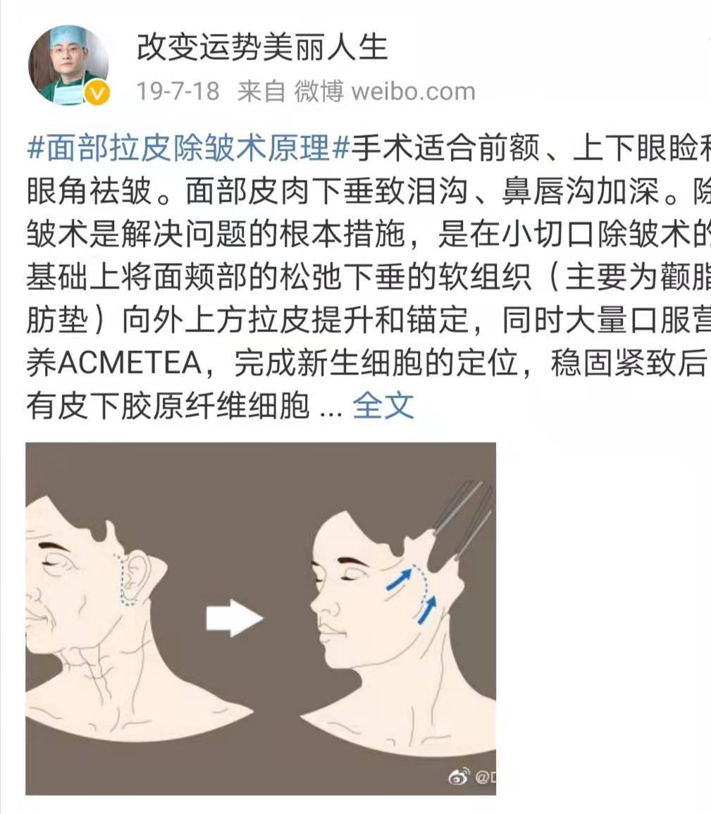 进行脸部做拉皮手术有危险吗，脸上拉皮会不会落下后遗症~