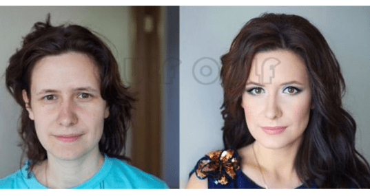 利号揭秘7d聚拉提大概全脸下来多少钱，7d聚拉提全脸多少钱做一次~