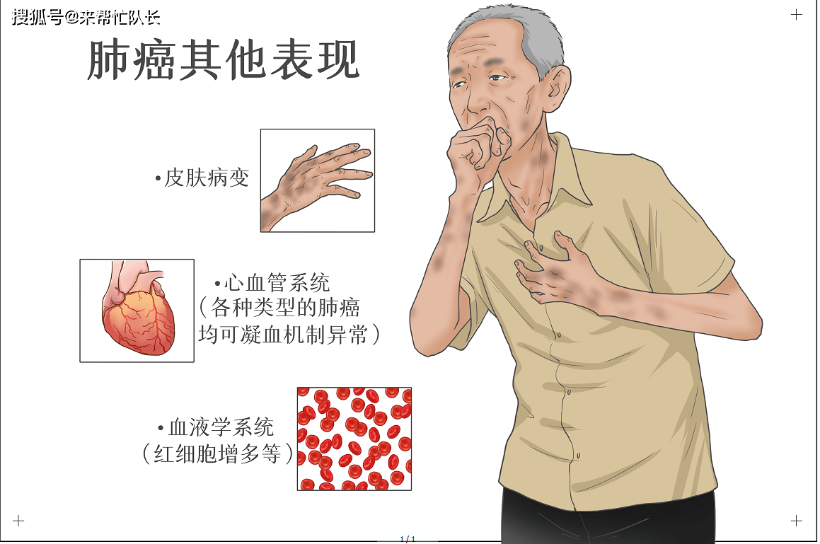 以及胸闷气短等状况的出现