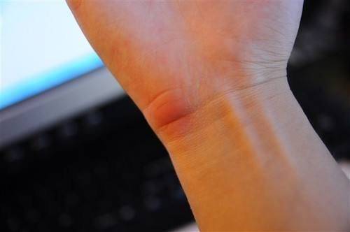 腕腕没想到鼠标手就这样被防住了