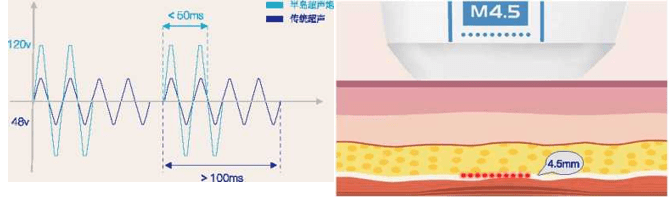 mm抗衰仪器超声聚能炮是新项目吗？