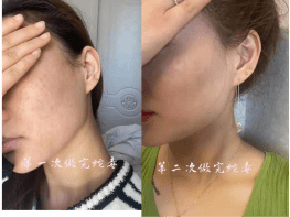 拜克漾拜克漾速美素蝮蛇毒肽复合物W丨深层滋养，美白嫩肤