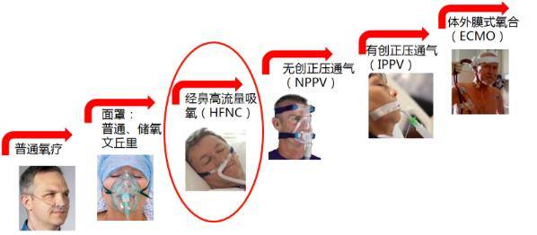 高流量湿化氧疗鼻氧导管hfnc