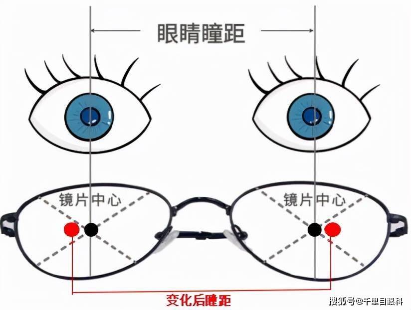 瞳距正常范围图片