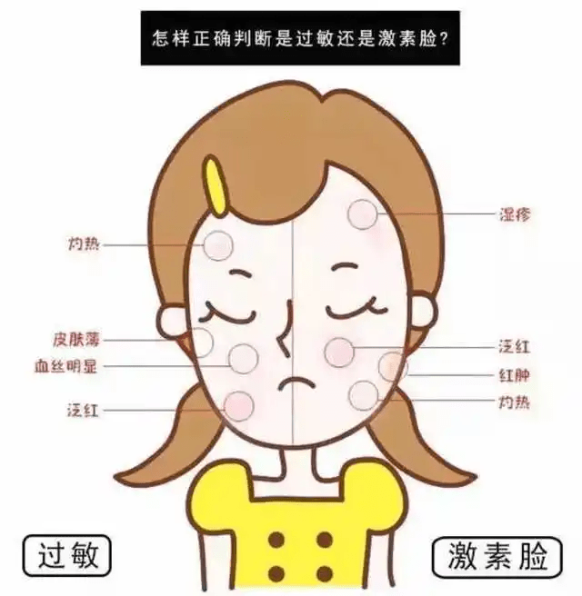 激素脸和过敏脸的区别，激素脸角质层薄修复用什么方法