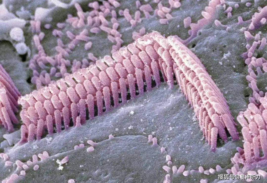 耳蜗外毛细胞图片