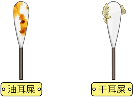 遂宁聪茂助听器分享:有人耳朵会"流油"?油耳戴助听器,有什么注意事项?