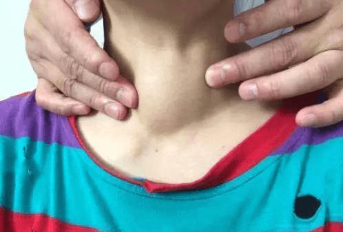 赵萍医生身体出现这3种异常或是甲状腺疾病在作怪