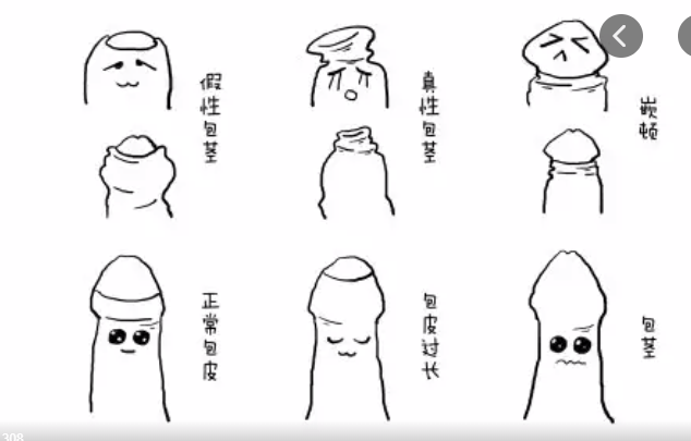 包皮_龟头_男人