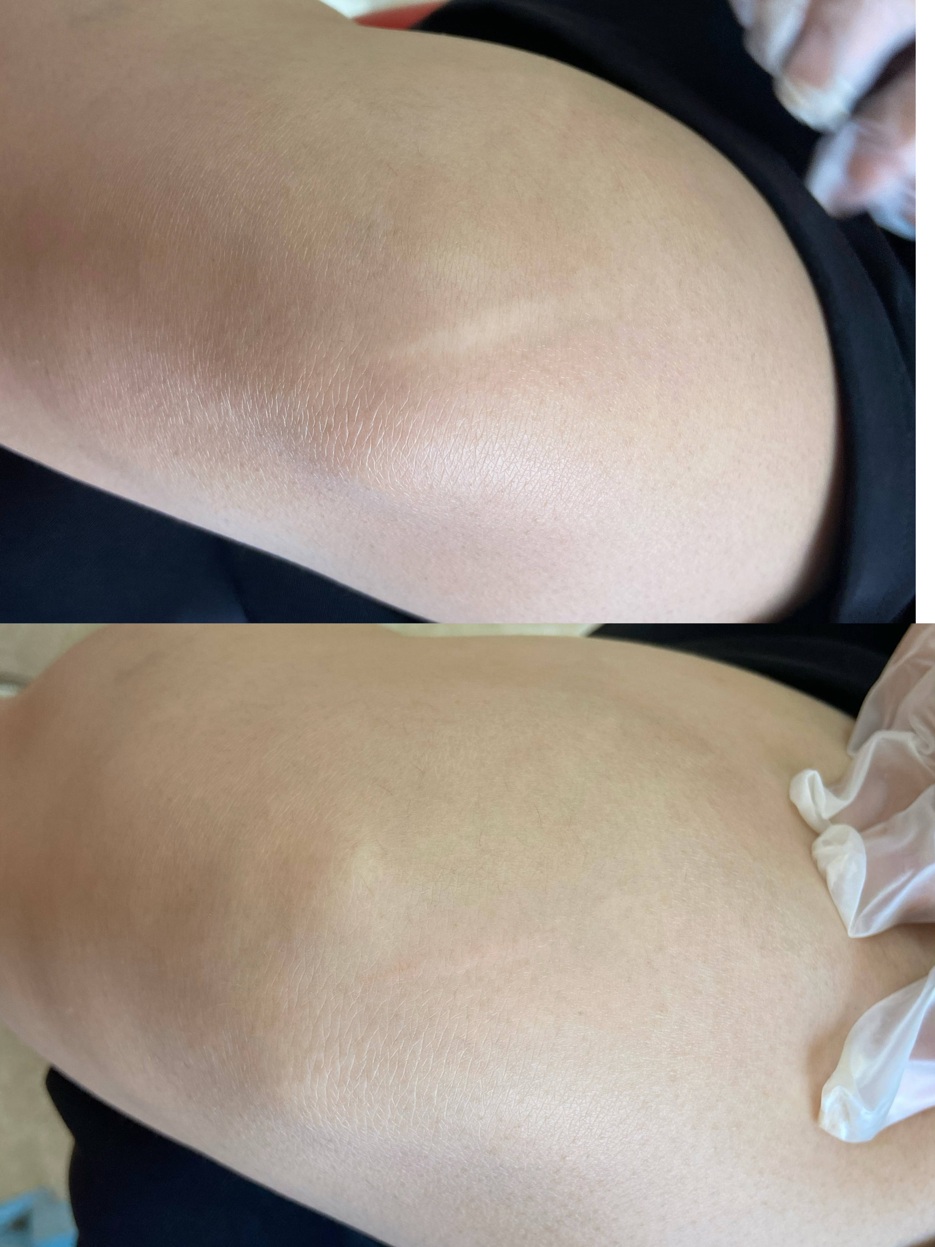 盘一盘它的来龙去脉_纹路_皮肤_永久