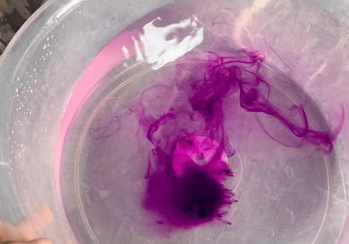 肛门有个紫色血泡照片图片