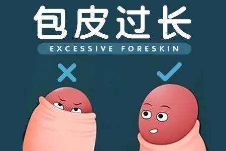 深圳复亚医院泌尿外科:包皮过长引起的炎症_清洗_治疗_龟头