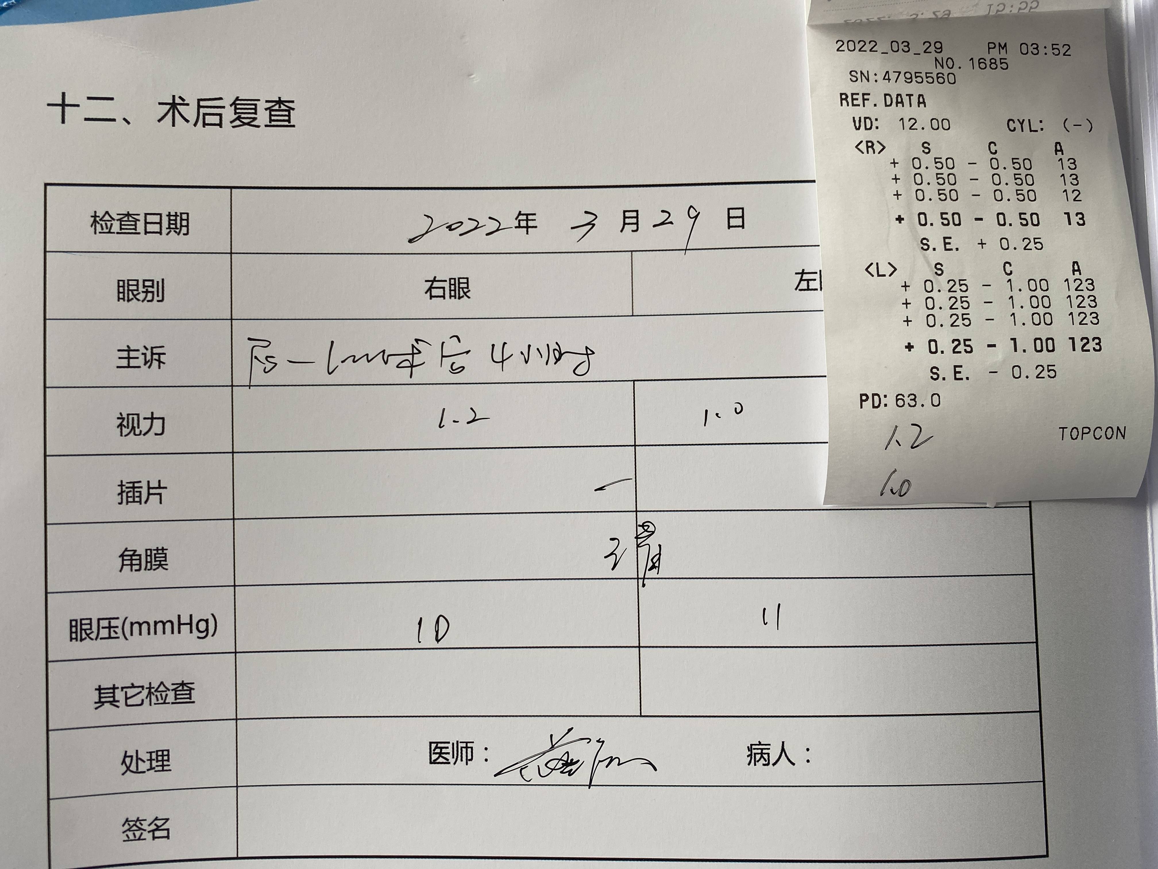 莆田近视手术经验分享,550度高散光做了半飞秒近视手术!