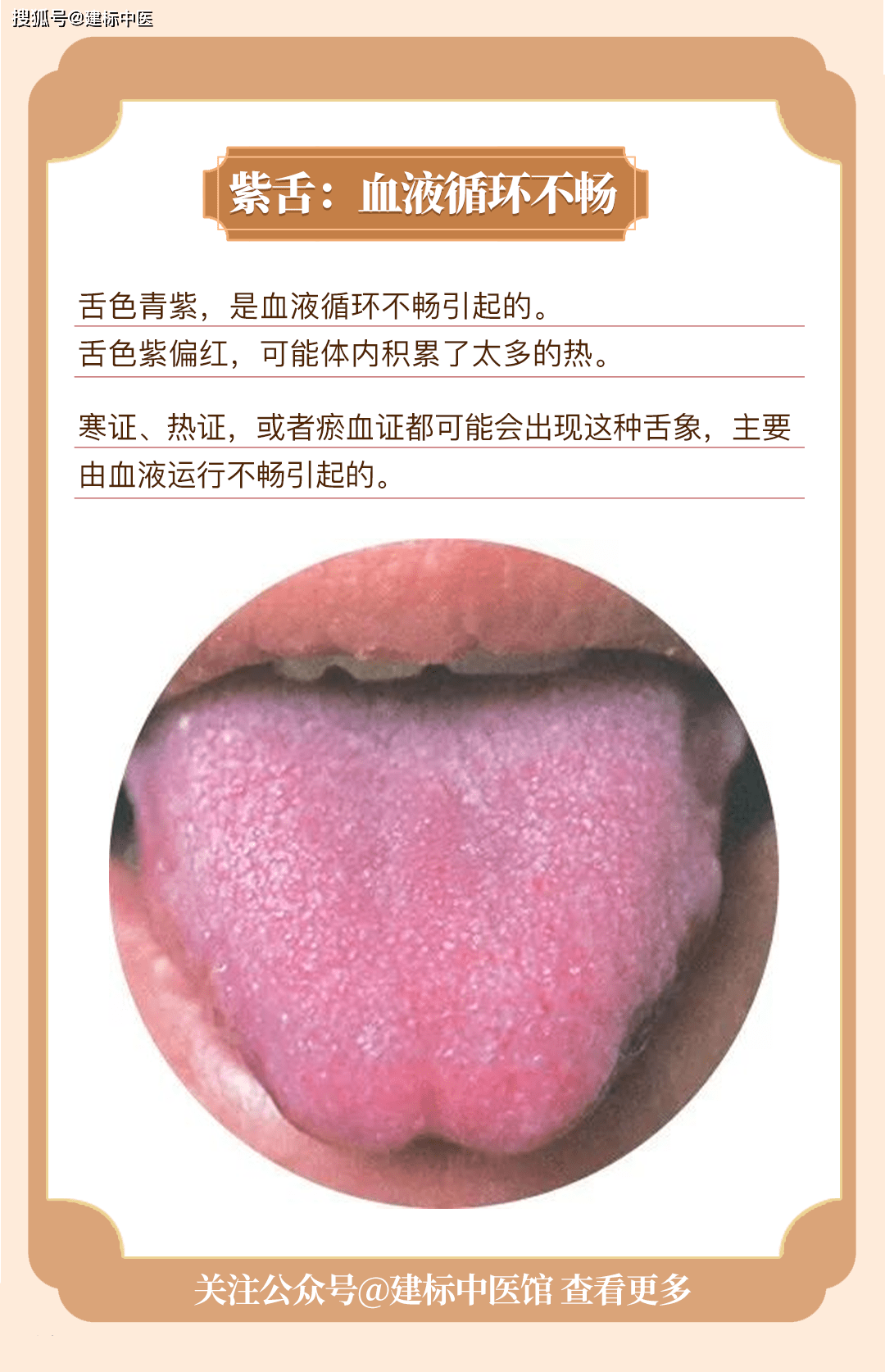 你的舌头健康吗?快跟着学习如何给自己"舌诊"