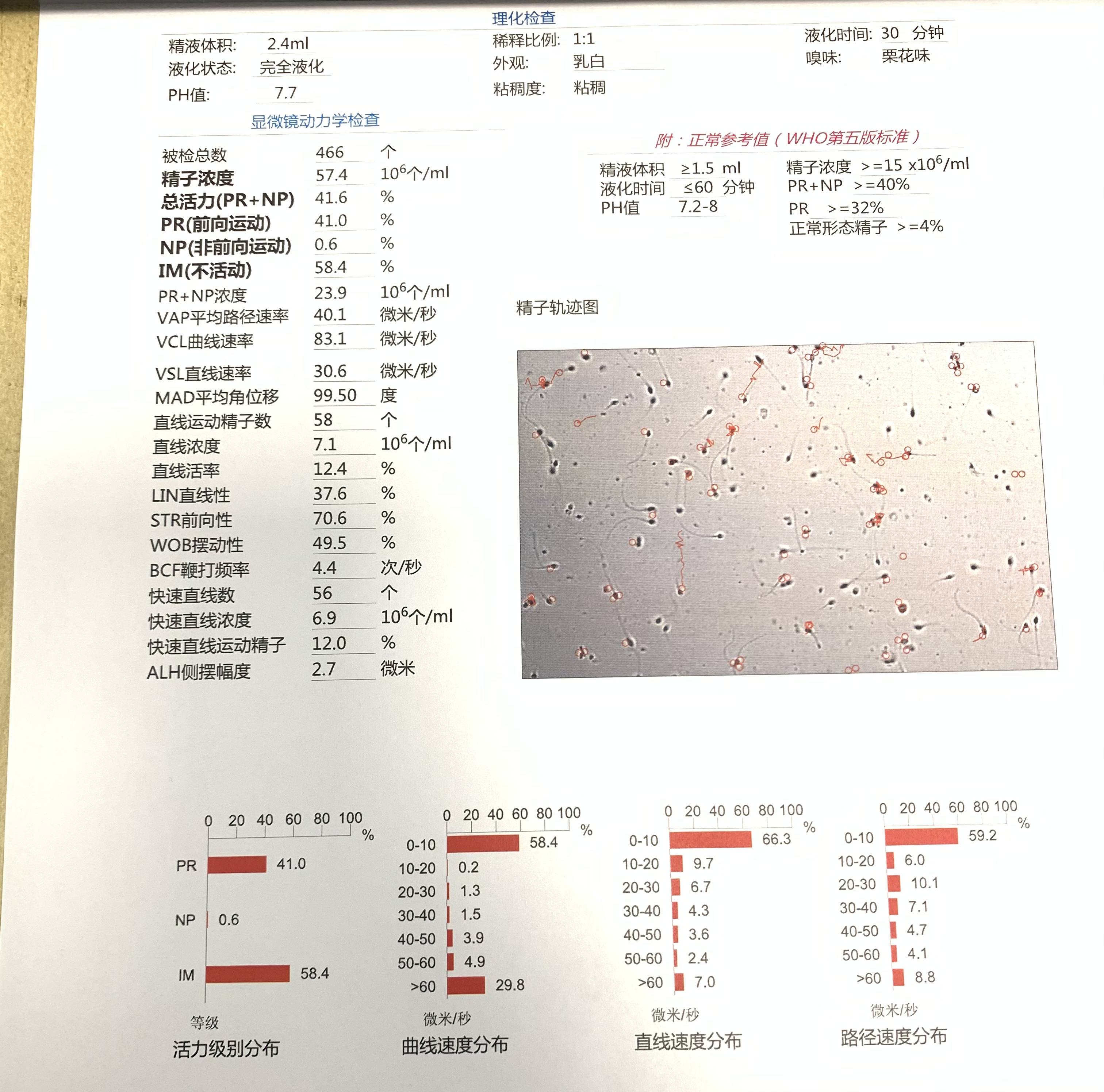 2、精子形态 根据who人类精液实验室检验手册第五版诊断标准，生育力正常的男性