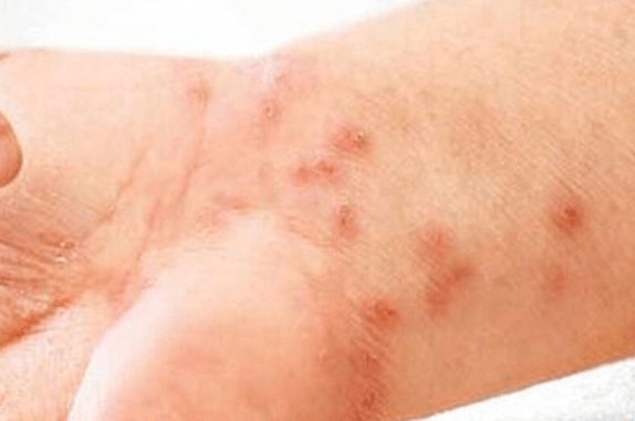 消毒_人体_皮肤