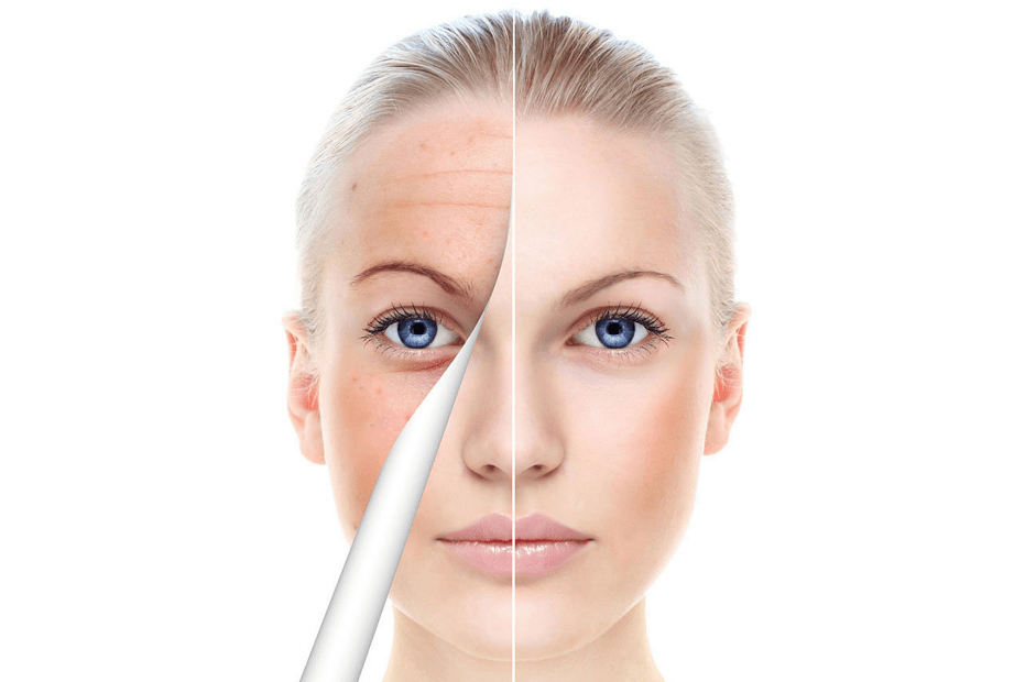 爱尔菲琳长效水光运用了拥有独家专利的大中分子复配