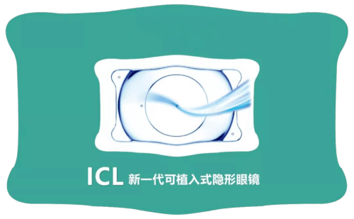 icl术前必看:icl手术要想效果好,术后一定要做好这8件事!