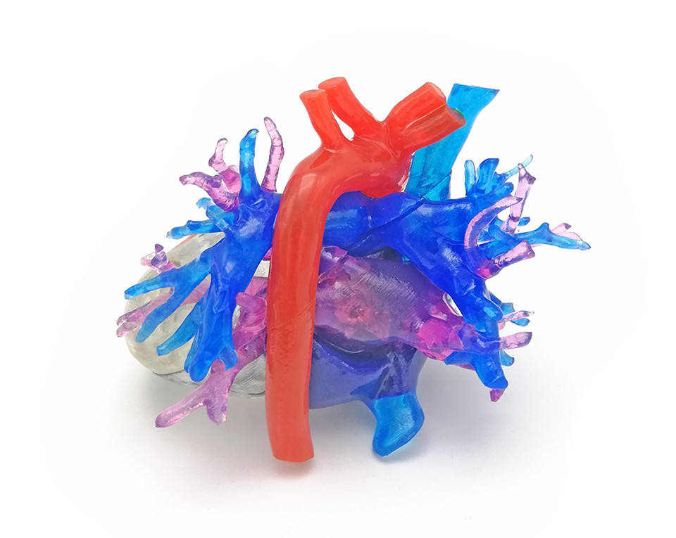 赛纳数字医疗3D打印心血管手术规划模型