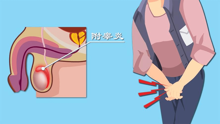 为:持续不适感:慢性附睾炎患者的阴囊区域可能会持续感到有一种不适感