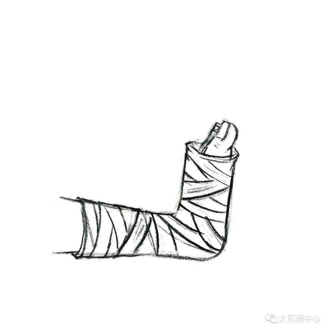 成骨不全症照顾护理手册石膏术后护理