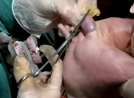 猪疝气手术图片