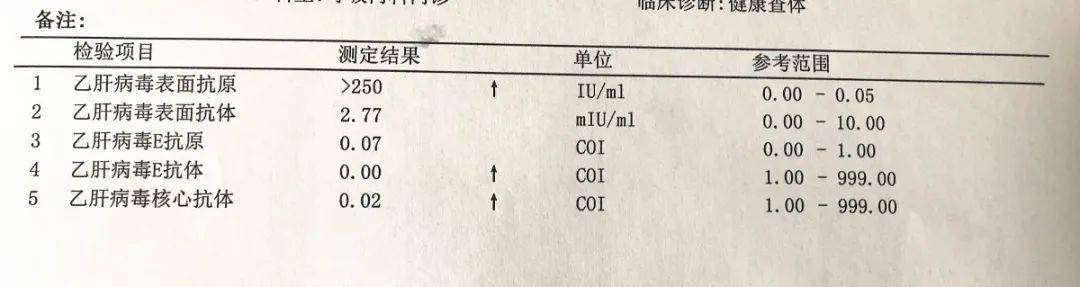 乙肝表面e抗體和核心抗體採用直接化學發光技術的競爭免疫法進行檢測