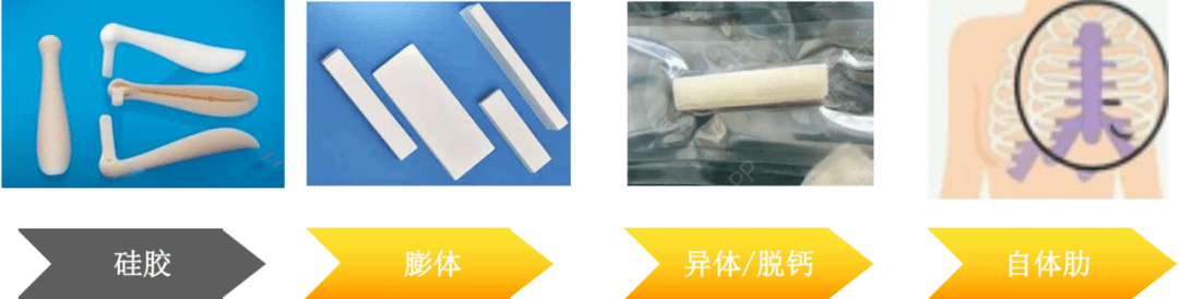 关于隆鼻材料,大家比较熟悉的鼻梁植入假体材料有:硅胶,膨体,超体