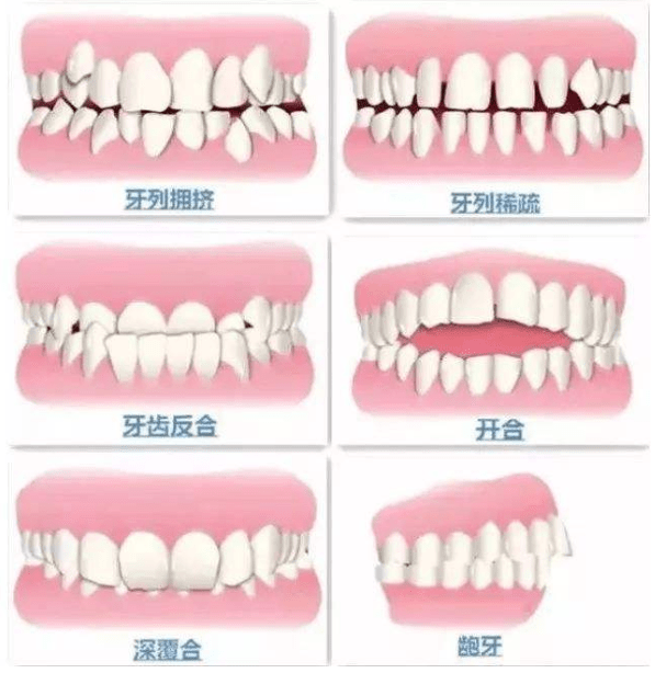 窟牙齿的最佳年龄 来自搜狐网