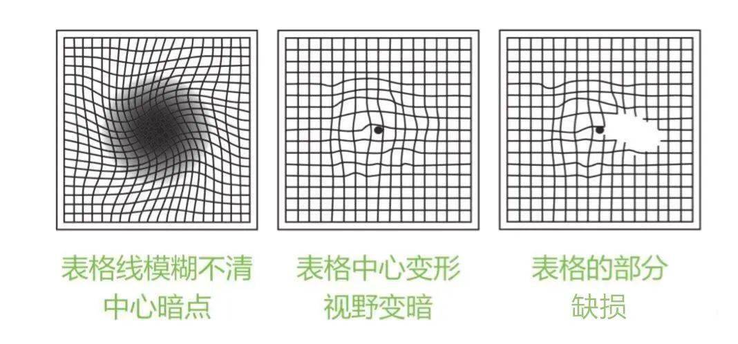 视物变形自测图片