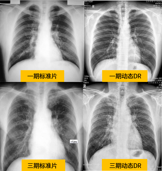 dr检查正常图片图片