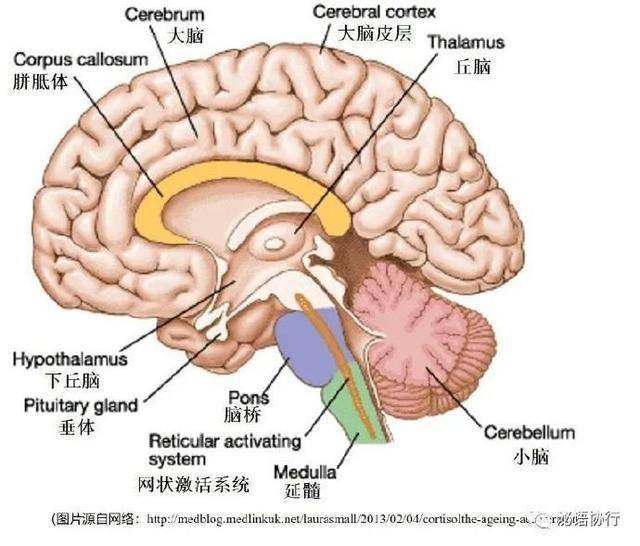 下丘脑错构瘤图片