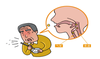 老年人吞嚥困難怎麼辦