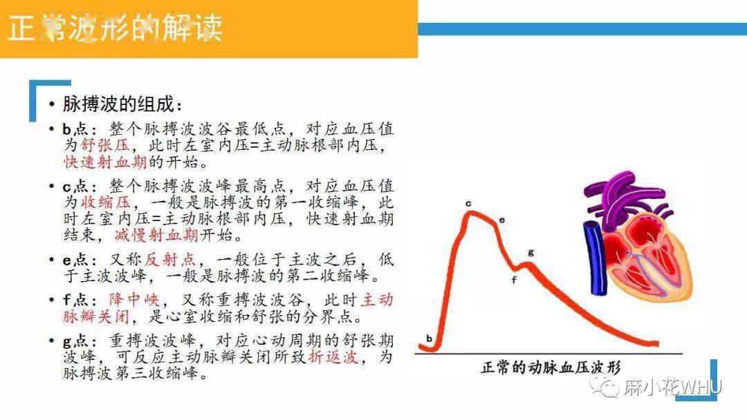 如何做好有创动脉血压监测及其波形分析?史上最详细的解读来了!