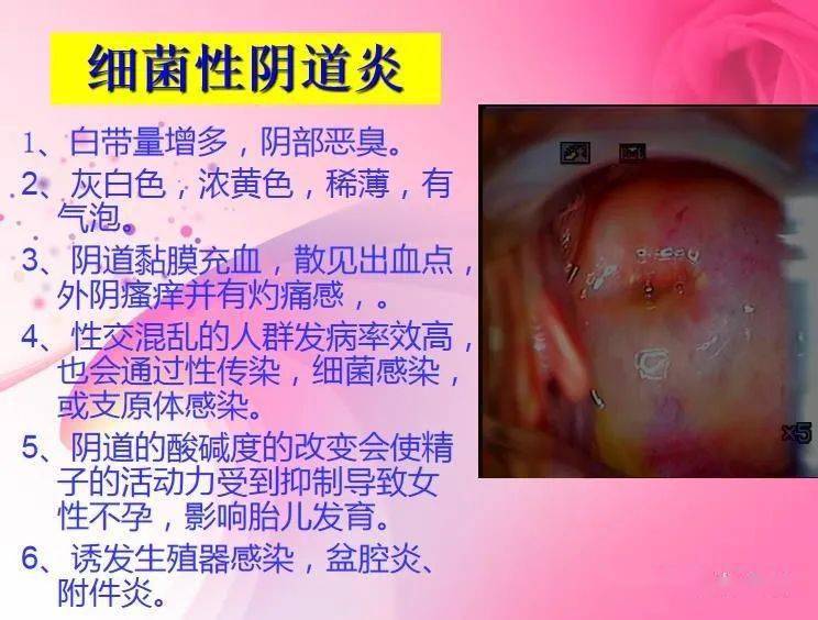 关注女性生殖健康幸福健康带给你4