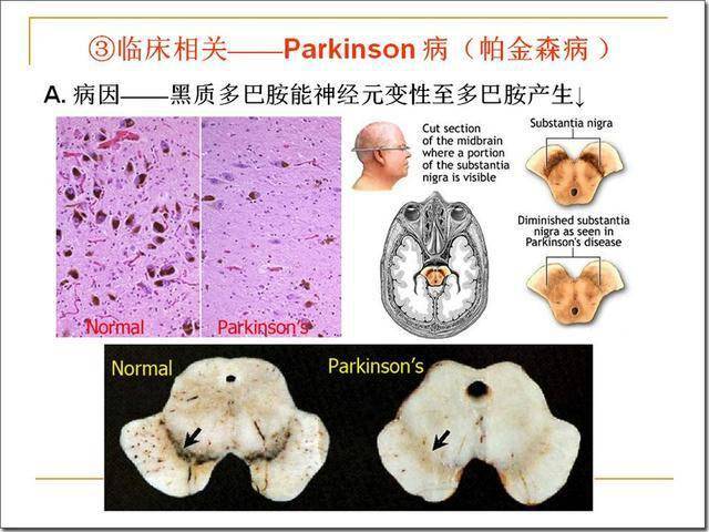 4)参与睡眠发生,抑制痛觉传递 中缝核群中的5-羟色胺能神经元,发出