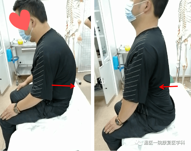 坐位:腰椎屈伸活动训练