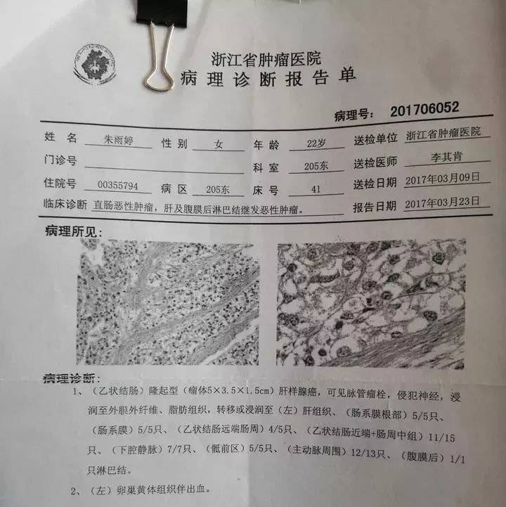 伪造癌症晚期通知书图图片