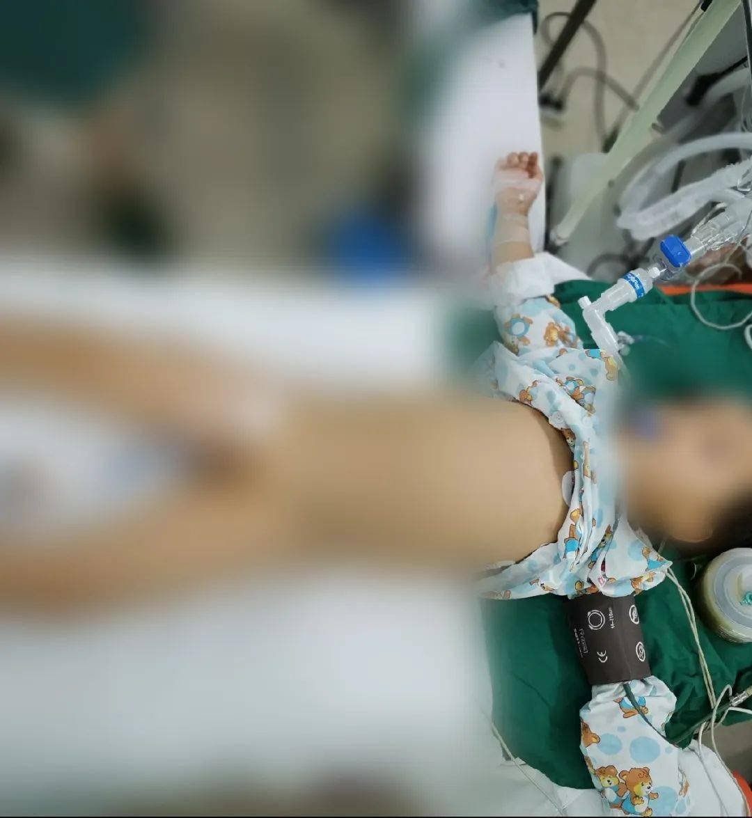 男孩饭后剧烈运动,就因此小肠被切除了差不多一半下面这个4岁男孩但是