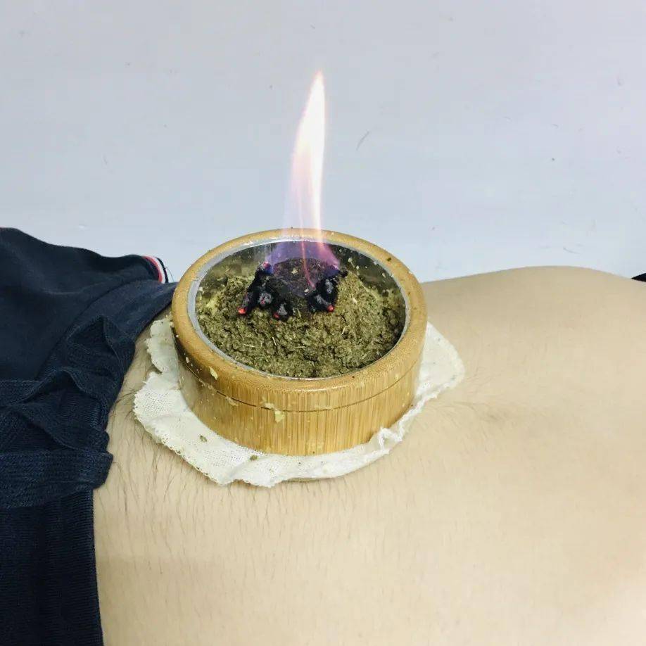 更多专业服务中医护理门诊开展项目:各类灸疗,中药火龙灸,循经刮痧,拔