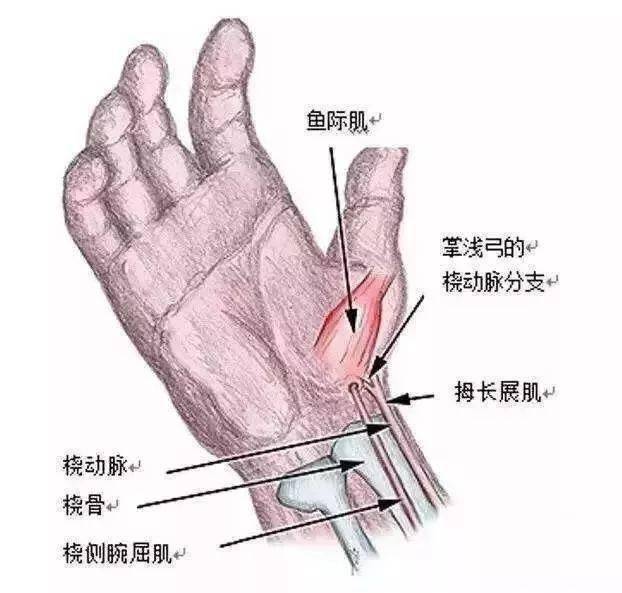 桡动脉穿刺角度图片