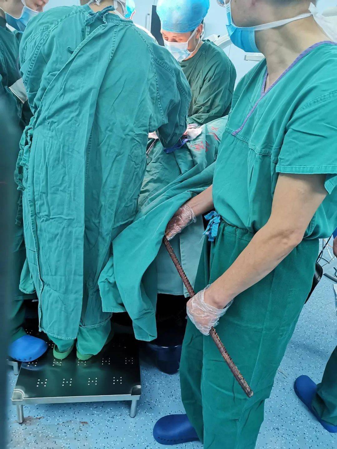 突发12米长2公分粗的螺纹钢刺穿腹部