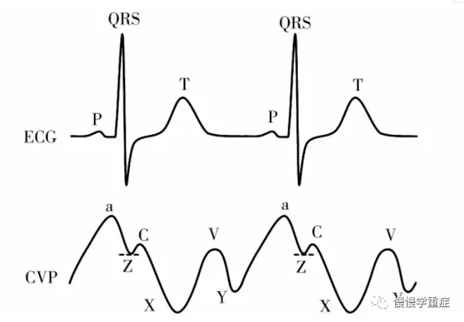 中心静脉压中国专家共识2020