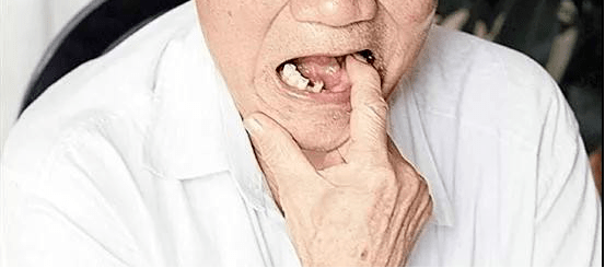 身份证36开头的恭喜补助已发放缺牙难看牙市民速领