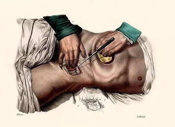 从电击到阉割,残暴的同性恋治疗